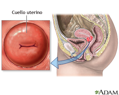 Cervix