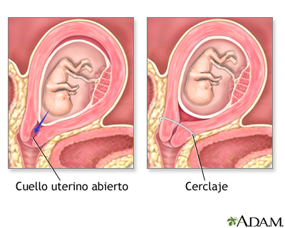 Cervix