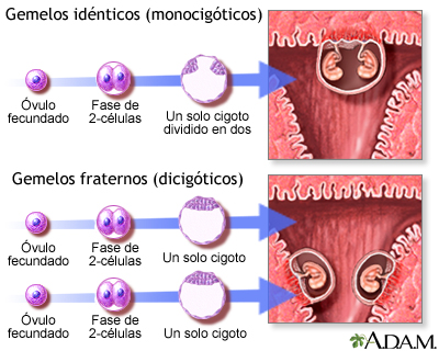 Gemelos