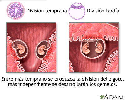 Gemelos