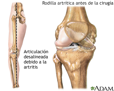 Indicación