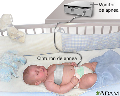 Monitor de apnea