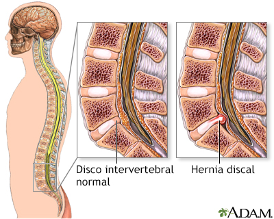 Anatomía normal