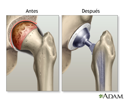 Cuidados postoperatorios