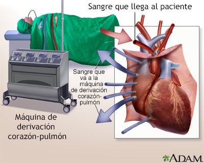 Procedimiento (primera parte)