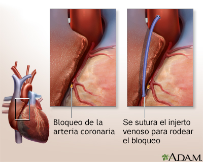 Cuidados postoperatorios