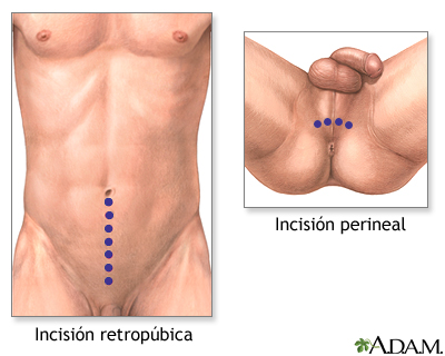 Técnicas