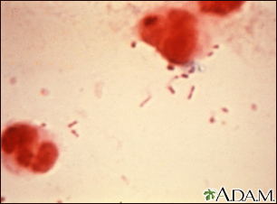 Organismo Haemophilus influenzae