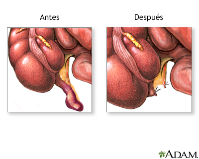 Cuidados postoperatorios