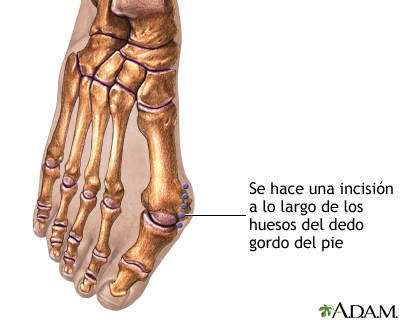 Procedimiento  (primera parte)