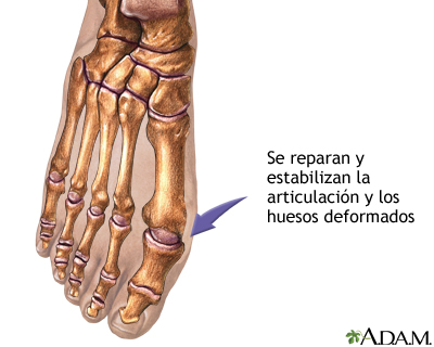 Procedimiento  (segunda parte)