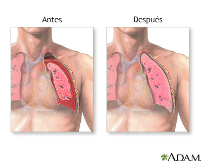 Cuidados postoperatorios