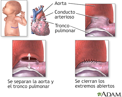 Procedimiento