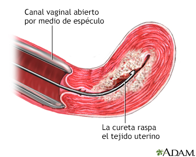 Procedimiento