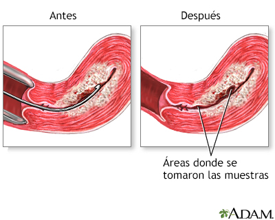 Cuidados postoperatorios