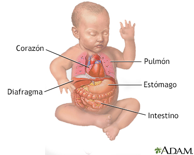 Reparación quirúrgica de una hernia diafragmática - serie