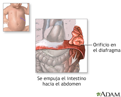 Procedimiento (primera parte)