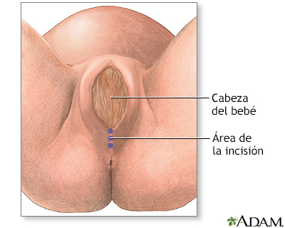 Indicación