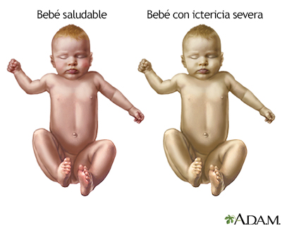 Indicaciones