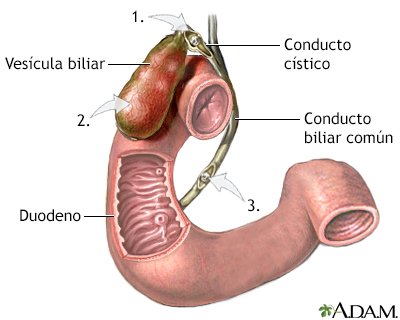 Indicaciones