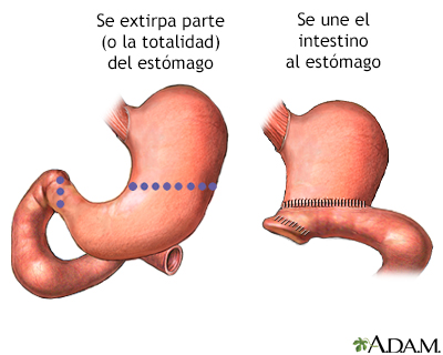 Procedimiento