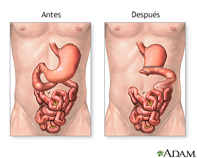 Cuidados postoperatorios