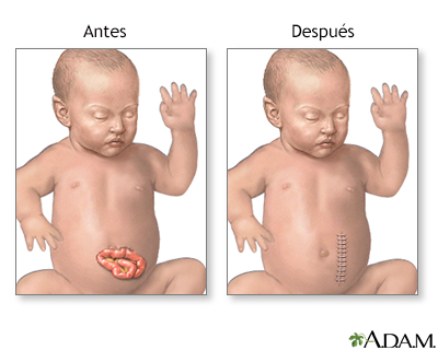 Cuidados postoperatorios