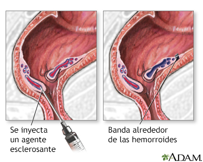 Procedimiento