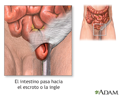 Indicaciones