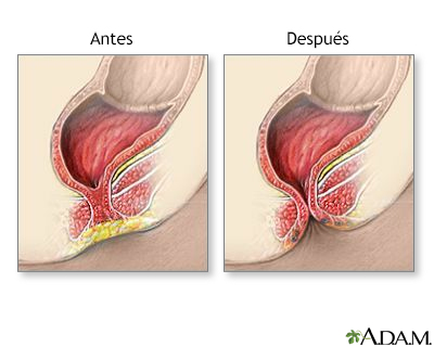 Cuidados postoperatorios