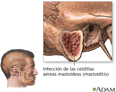 Indicaciones