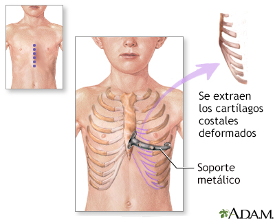 Procedimiento