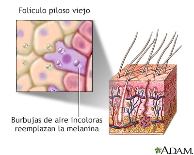 Folículo piloso envejecido