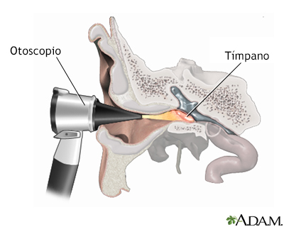 Examen con otoscopio