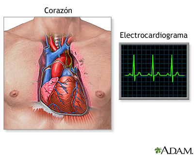 Electrocardiograma (ECG)