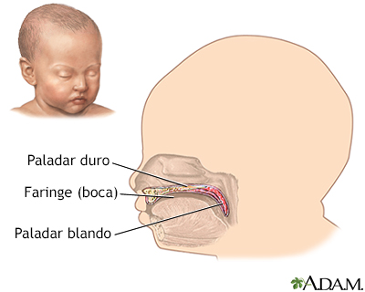 Paladares blando y duro