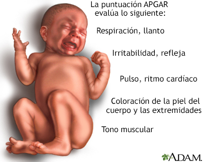 Examen del recién nacido