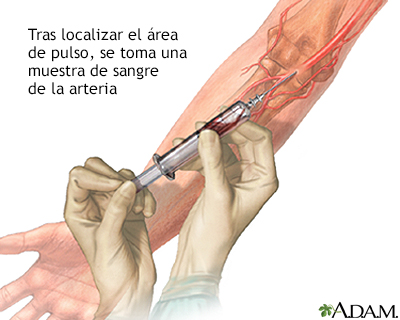 Muestra de sangre arterial