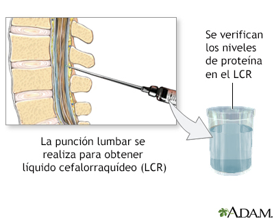 Examen de proteína del LCR