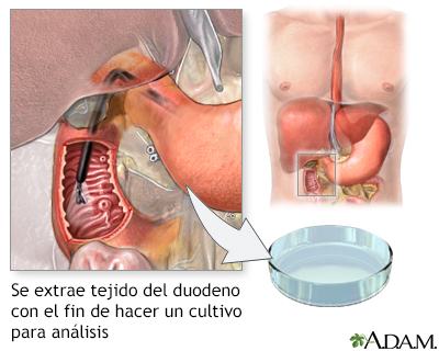 Cultivo del tejido duodenal