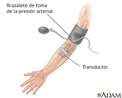 Examen de ultrasonido Dúplex/doppler