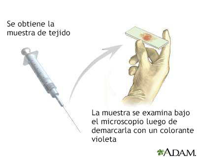 Tinción de gram de biopsia tisular