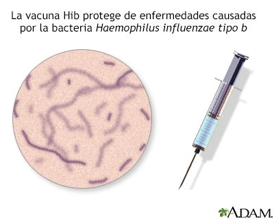 Inmunización o vacuna contra Hib