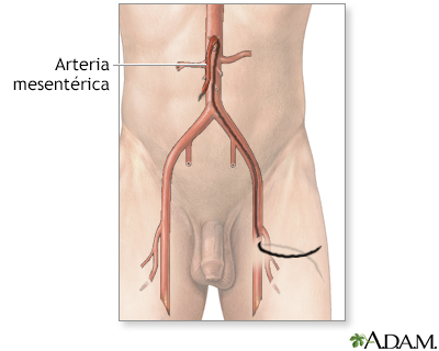 Arteriografía mesentérica