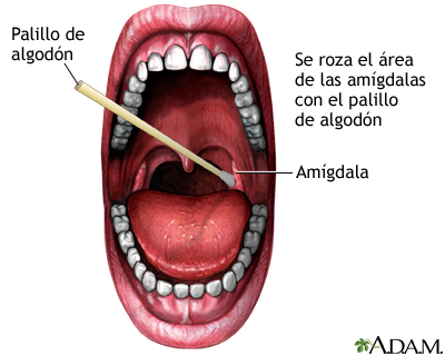 Cultivos de garganta