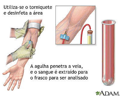 Exames de sangue