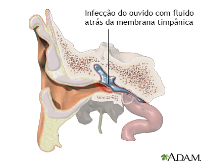 Indicação