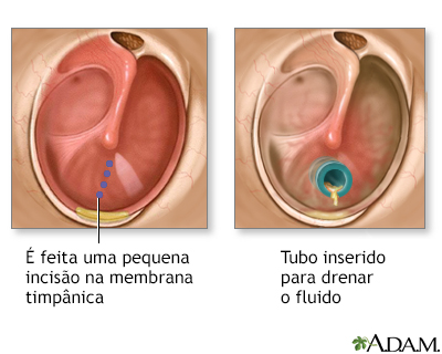 Procedimento