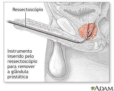 Procedimento