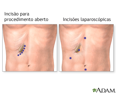 Cuidado após o procedimento